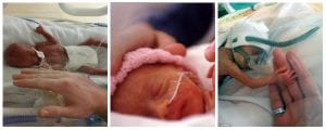 Son falsas las fotos referidas a la beba que nació luego de una cesárea a una nena de 12 años en Jujuy