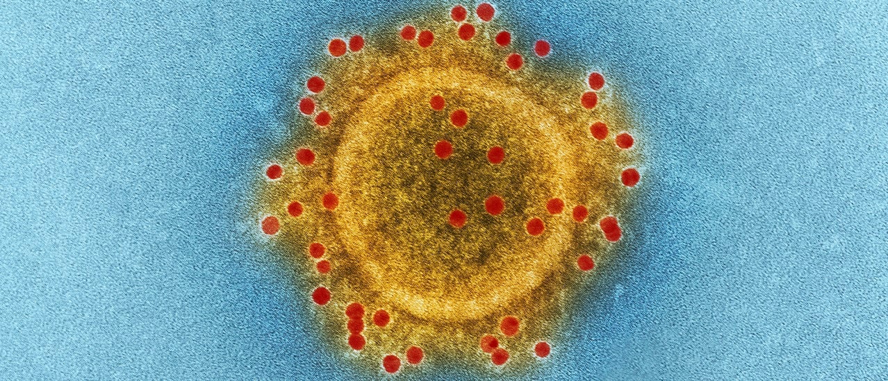No hay evidencia de que el coronavirus haya sido creado en un laboratorio; qué sabemos de su origen