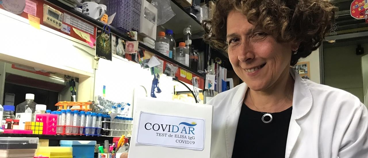 En tiempo récord: científicos argentinos ya desarrollaron un test local para medir anticuerpos contra el coronavirus