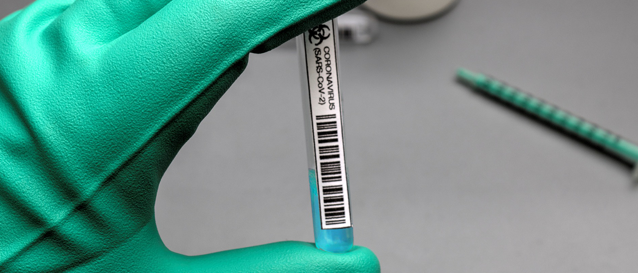 Diez razones para ser realistas sobre la vacuna de COVID-19 y no esperar un milagro