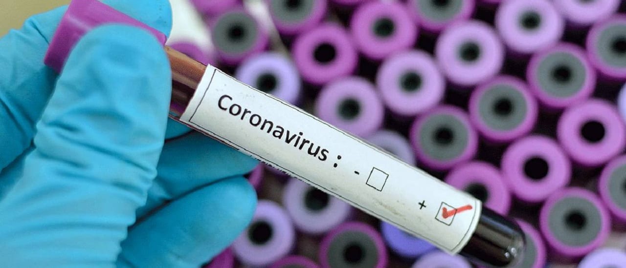 Qué tratamientos se emplean hoy contra el coronavirus y cuáles están aún en estudio